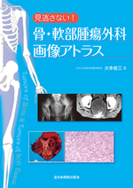 見逃さない！骨・軟部腫瘍外科画像アトラス |全日本病院出版会
