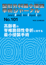 整形外科最小侵襲手術ジャーナル（J MIOS） 101|全日本病院出版会